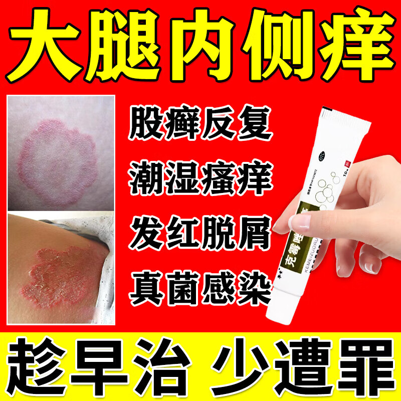 克霉唑乳膏股癣用药膏大腿内侧阴囊私处瘙痒股癣膏股藓皮肤瘙痒皮炎