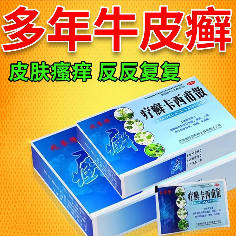 廯红肿起皮反复发作非外用药 1盒【牛皮癣用药兆誉隆疗癣卡西甫散16