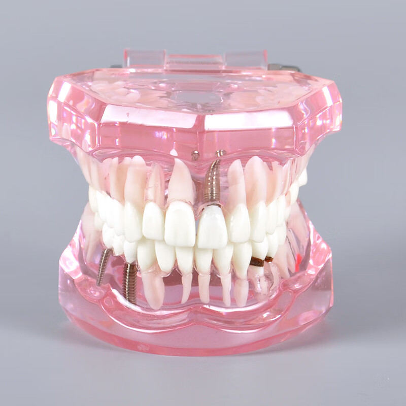 牙齿牙科考试模型 牙科口腔牙齿模型口腔病理医患沟通体综合模型可拆卸牙模医用模型 粉色口腔牙齿修复模型