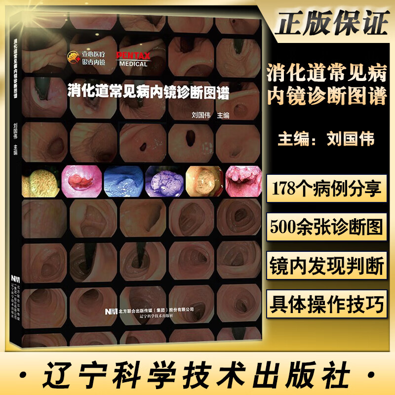 消化道常见病内镜诊断图谱 刘国伟 消化系统疾病诊断图片案例分析 消化道内窥镜检图谱 内科医师 辽宁