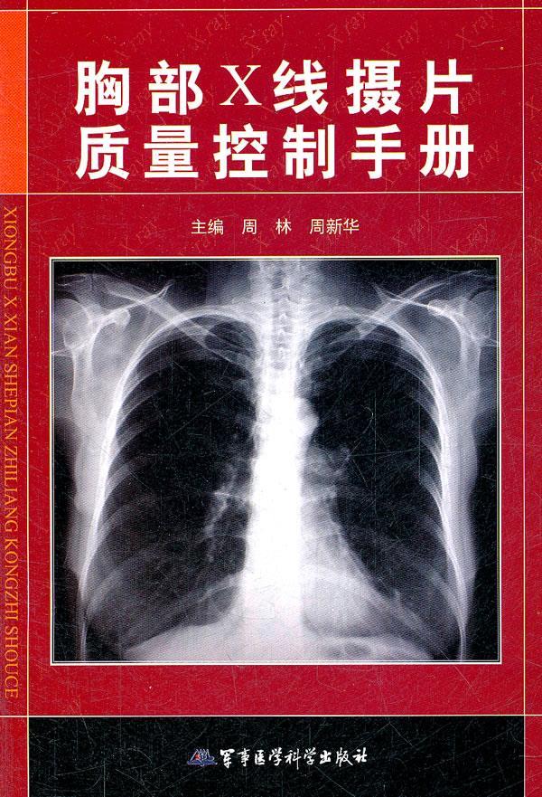 胸部X线摄片质量控制手册怎么样,好用不?