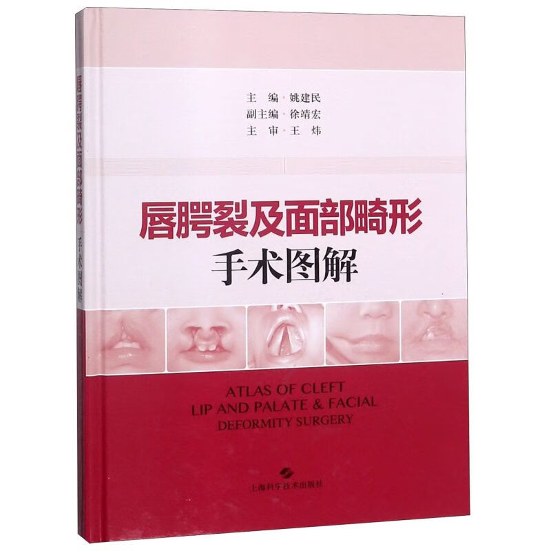 唇腭裂及面部畸形手术图解(精)