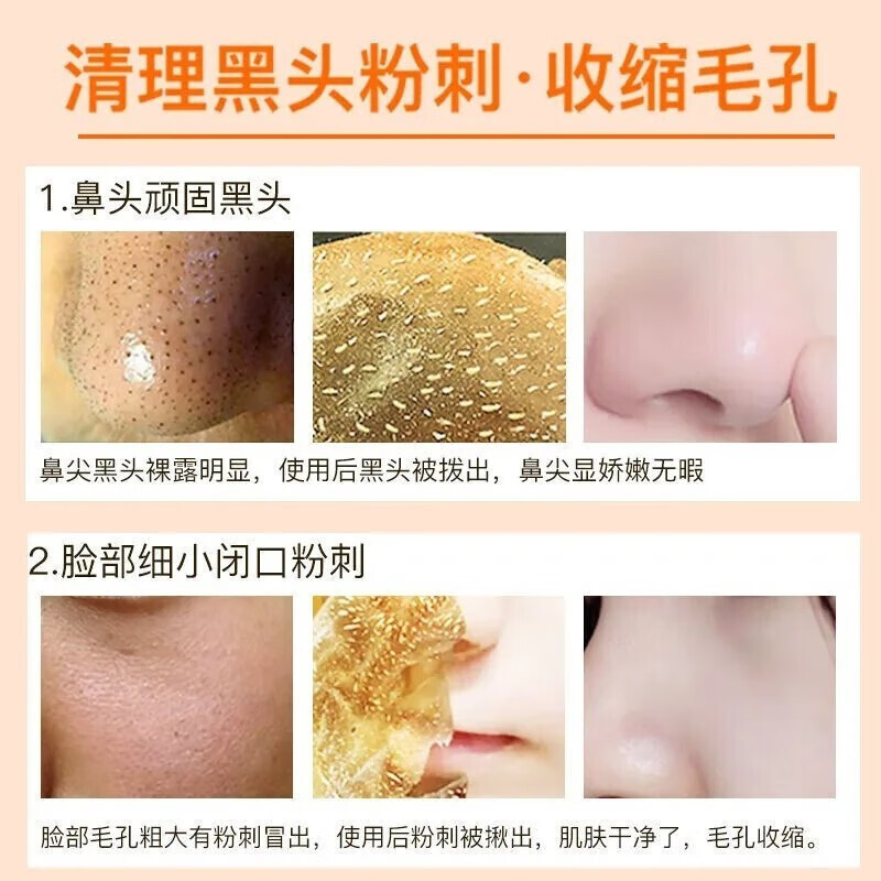 南京同仁堂去黑头撕拉面膜去吸鼻贴男女通用收缩毛孔深层清洁面膜祛粉刺死皮鼻80g 一瓶装80g大容量【针对毛孔黑头见效装】