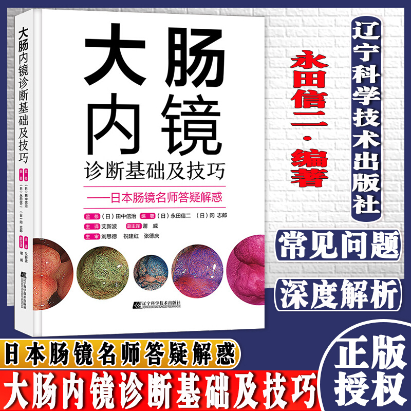 大肠内镜诊断基础及技巧 （日）永田信二 辽宁科学技术出版社 医学书籍k