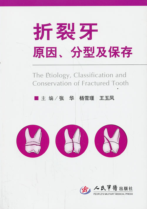 折裂牙原因、分型及保存【正版图书】