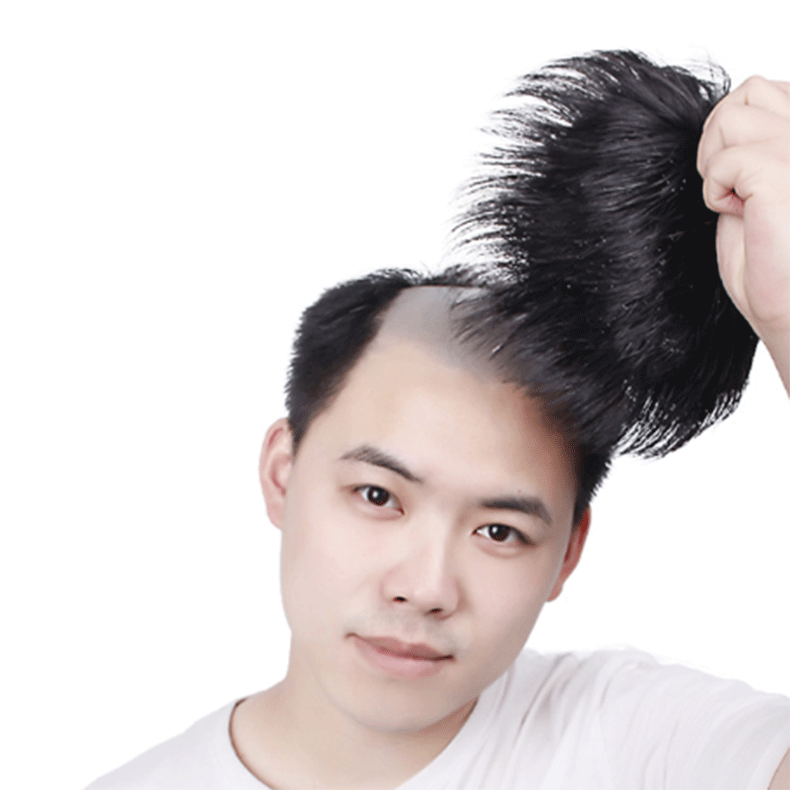 长发公主男士补发片假发套头顶补发前额秃顶补发垫接发翻盖假发真发男
