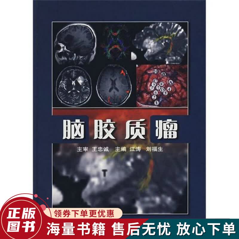 脑胶质瘤