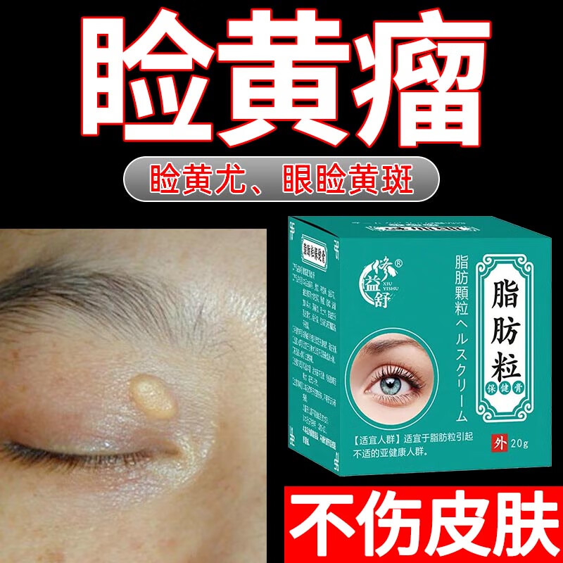 药房直售 睑黄瘤祛除眼睑黄瘤去睑黄疣软膏眼部脂肪粒趁机黄色小 一