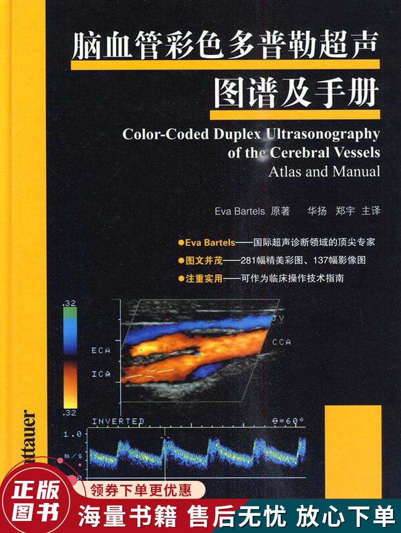 脑血管彩色多普勒超声图谱及手册