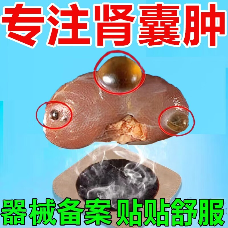 肾囊肿专用中草非药贴腹部疼痛调理消穿刺硬化搭配治疗腰疼肾脏虚弱