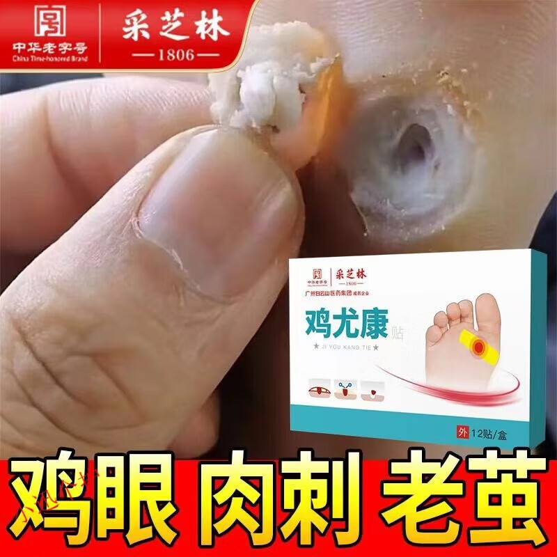 丝幕鸡眼膏鸡眼贴老茧脚茧死皮茧刺猴趾优足部护理鸡尤康贴 单盒体验