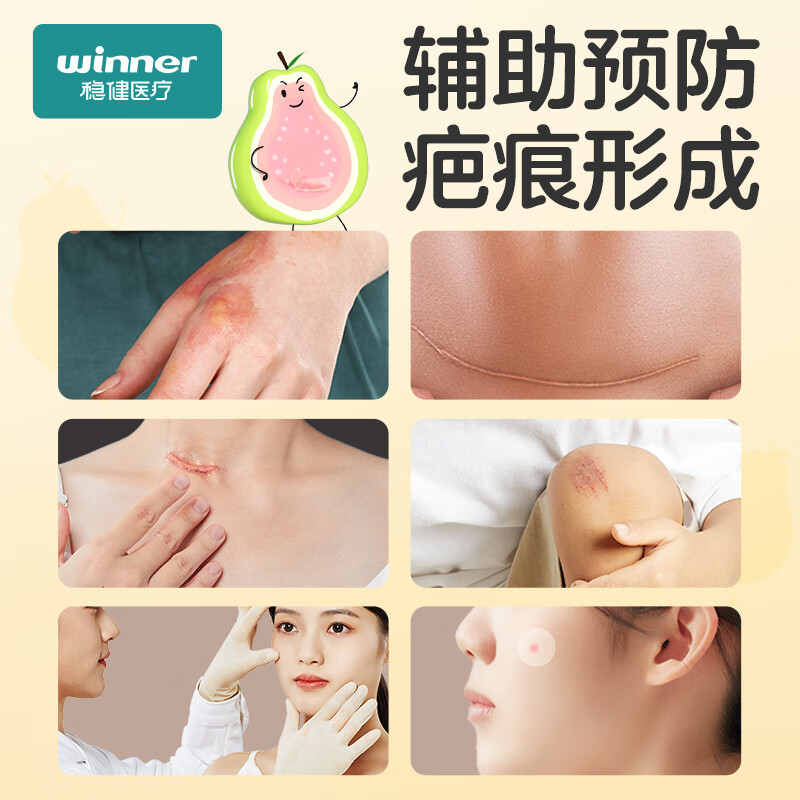 稳健医用疤痕凝胶自风干型祛疤硅凝胶疤痕膏剖腹产术后烧伤烫伤痘印手术擦割伤疤痕辅助预防 【进口原料】硅酮疤痕凝胶Ⅱ型12g/支