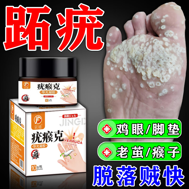 舰】北京同仁堂跖疣脚底趾疣去老茧肉刺脚垫面部扁平疣丝状疣刺瘊痦子