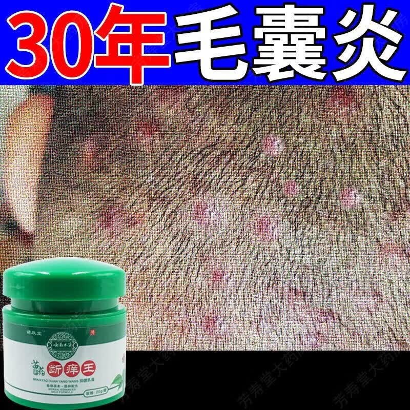 背部脓包疙瘩痤疮痘痘红肿皮肤止乳膏痒毛囊l炎现头部专用抑菌膏货 1