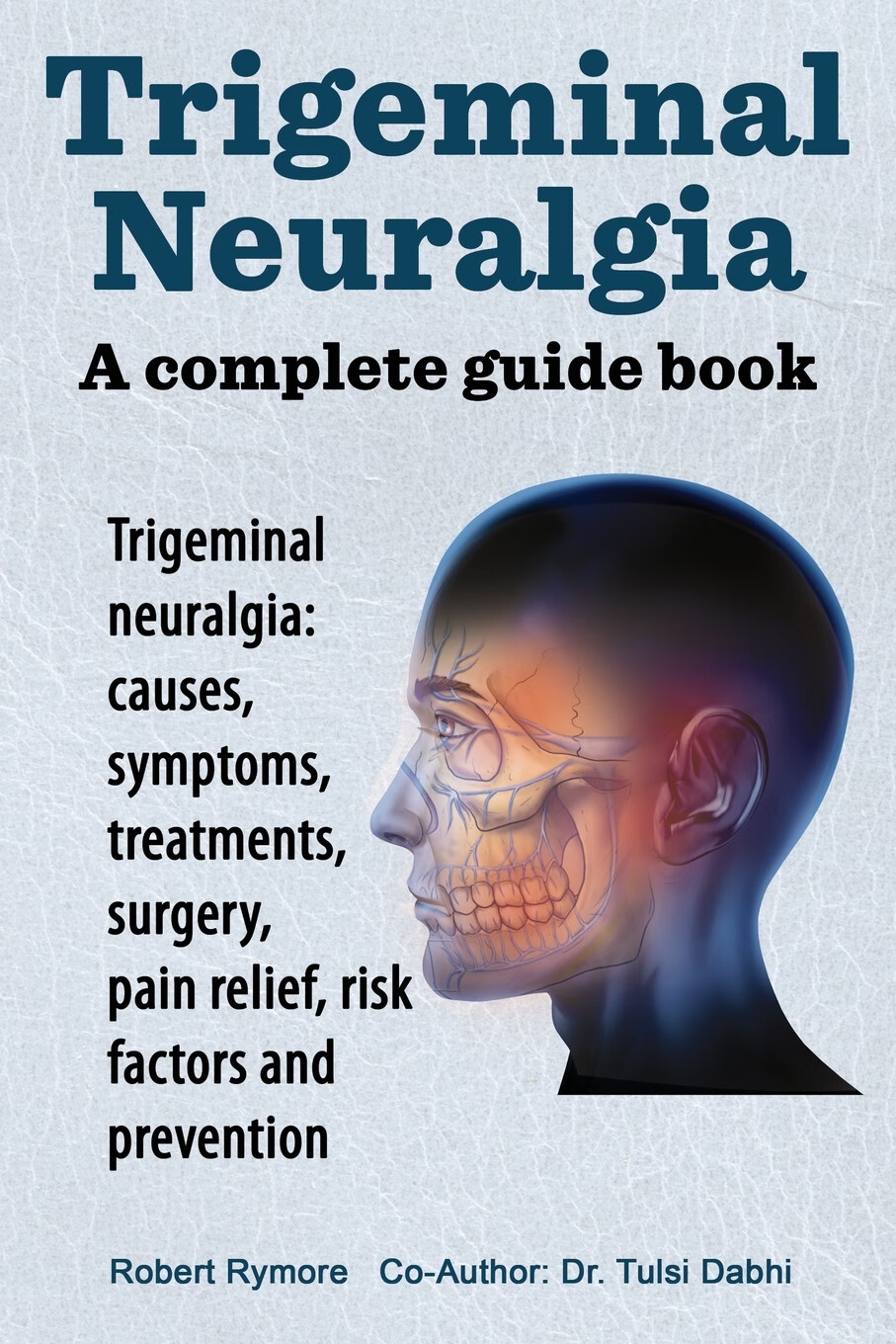 trigeminal neuralgia: causes, symptoms, treatme
