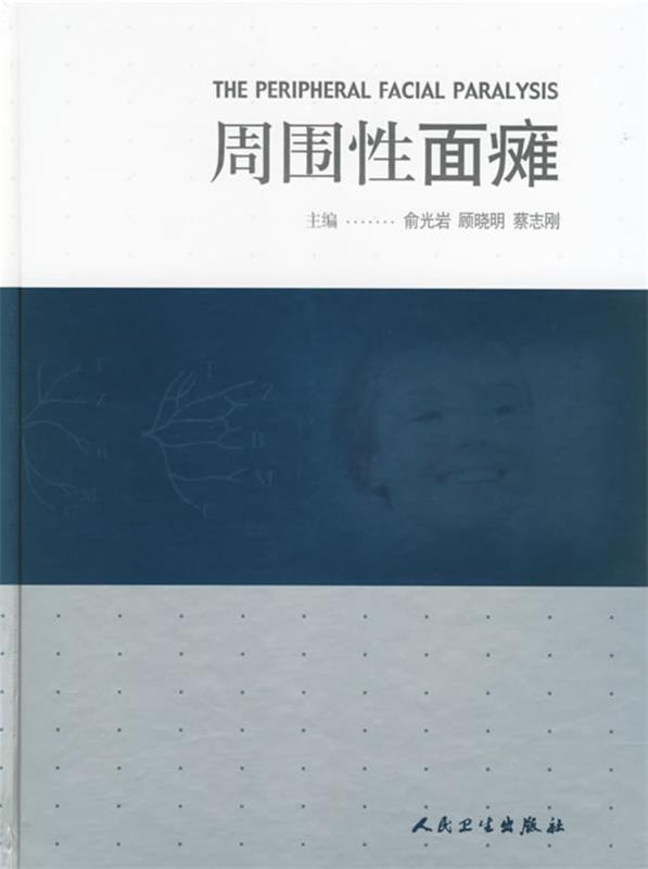 周围性面瘫