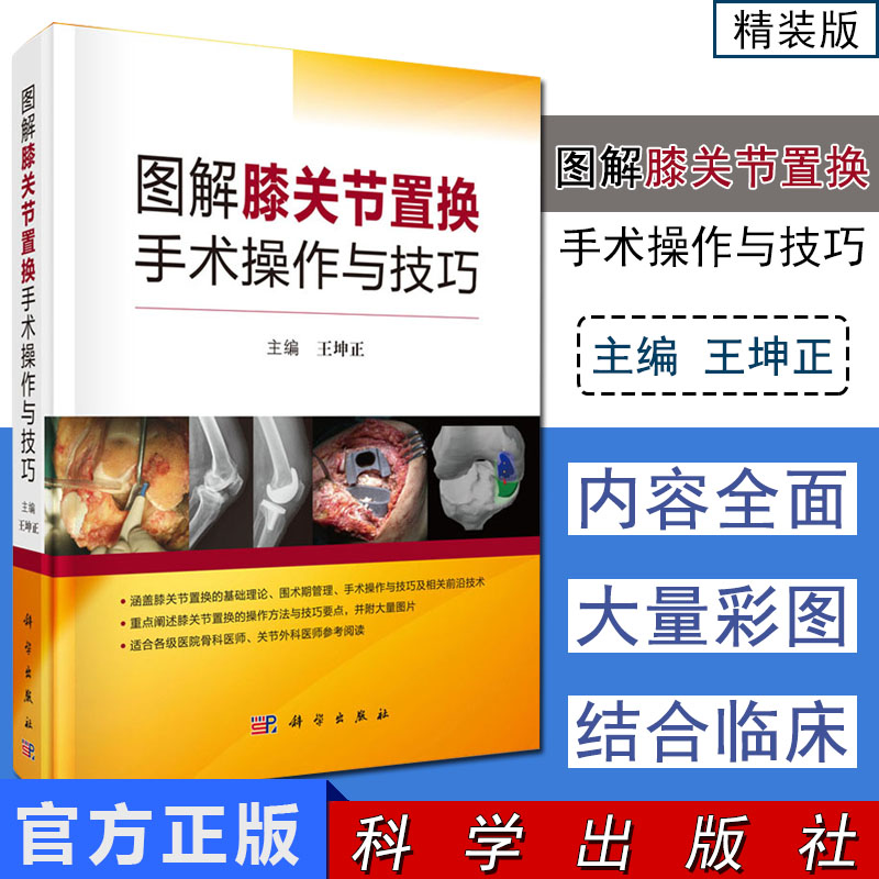 微创技术 导航技术 3d打印技术及机器人在人工膝关节置换中的应用