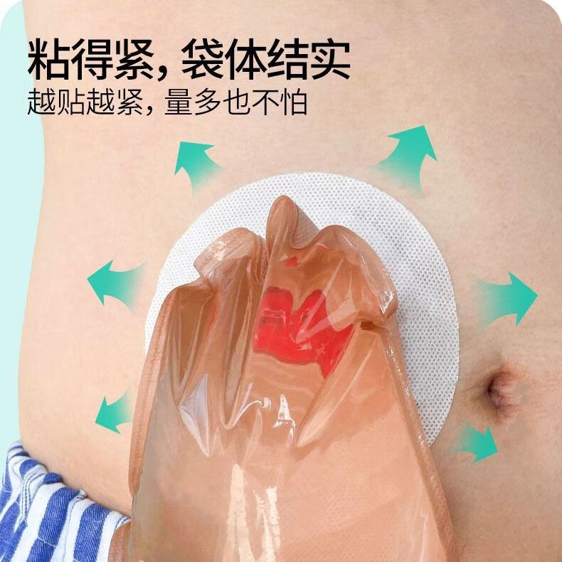肛门肛肠直肠癌造瘘术后大便袋一次性粪袋 9160一盒[十片 3个封口夹]