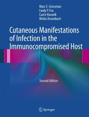 预订 cutaneous manifestations of infection in the
