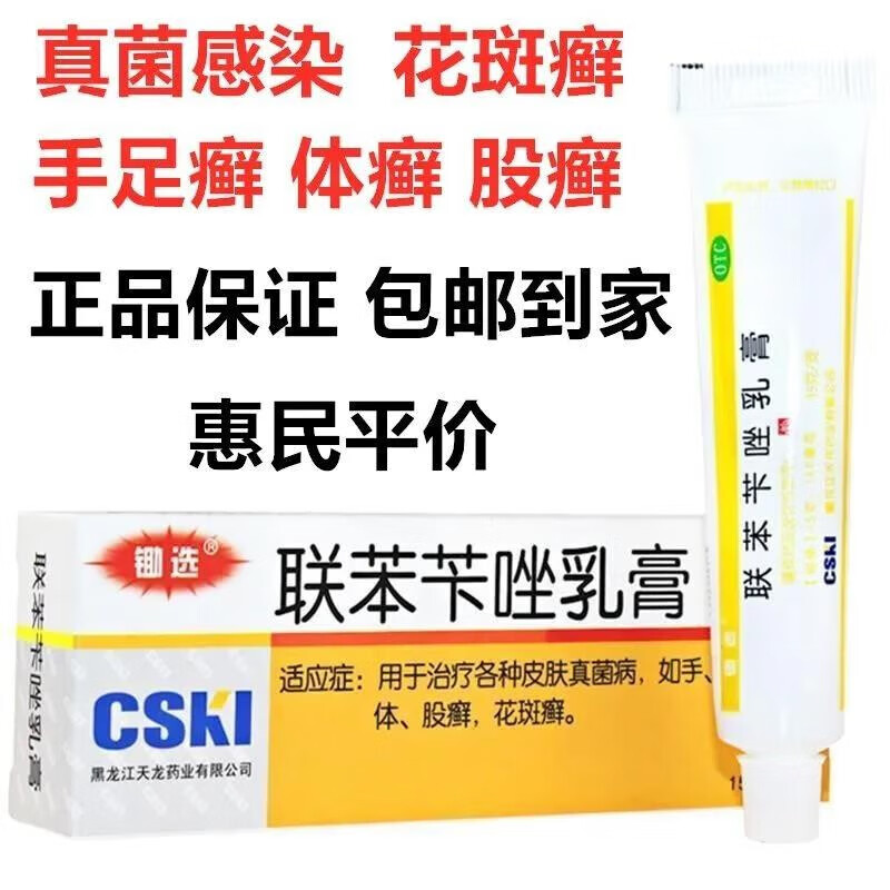 手足癣体癣联真菌感染股癣花斑癣的药膏苯下唑乳膏软膏霜联苯苄唑乳膏
