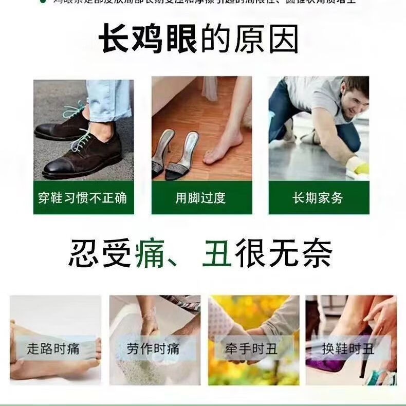 脚垫趾底手足鸡眼膏 [专攻严重型鸡眼] 2888倍效[超强效果]严重鸡眼两