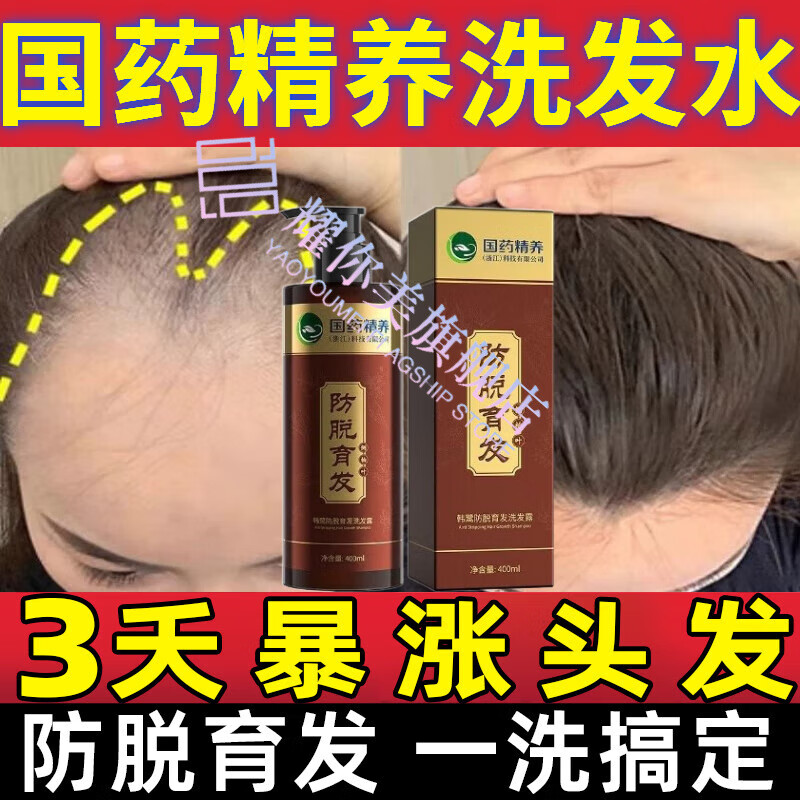 耀你美aik正爱防脱洗发水防脱去屑止痒控油蓬松洗头膏清爽留香男女通用 【持证防脱 无效送你】防脱育发 官方授权