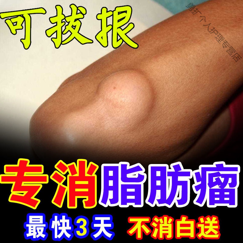 【98%脂肪瘤患者选择】脂肪瘤消除膏贴去皮下脂肪瘤多单发性粉瘤 一盒