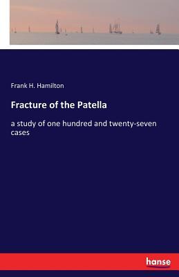 预订fracture of the patella: a study of one hundred