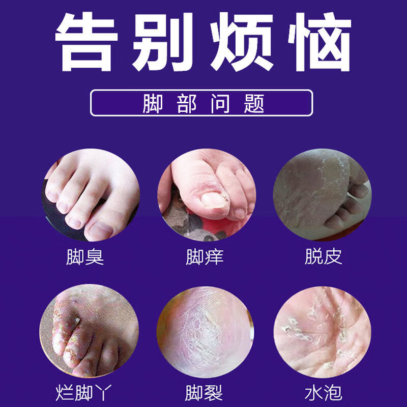 足之爱足爽乳膏脚痒脱皮去l脚臭止痒蚊虫叮咬消l炎去l水泡抑制乳膏
 买3+2【五盒巩固装】