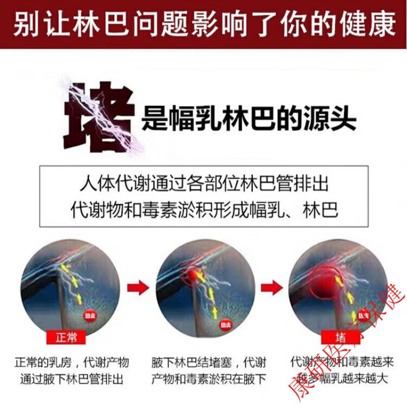 去副乳膏副乳消除贴膏去腋下淋巴结节副乳肿大凸起散结疏通神器收副乳
