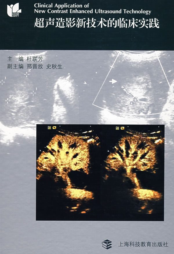 超声造影新技术的临床实践 杜联芳主编【书