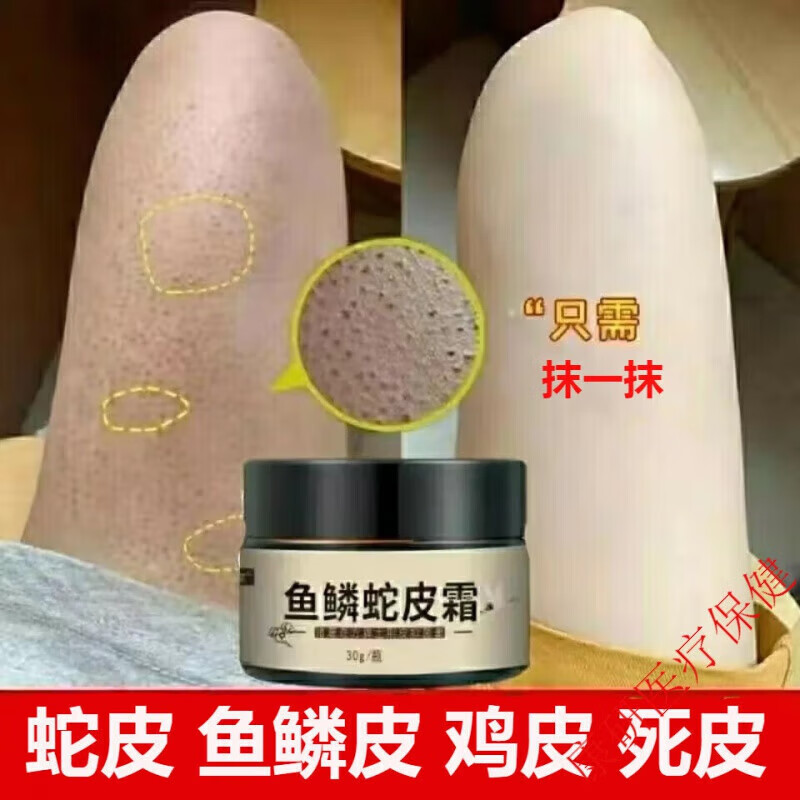 鸡皮肤霜鱼鳞皮肤蛇皮肤软膏【秋冬护肤】大小腿部鳞屑干燥纹路脱皮起
