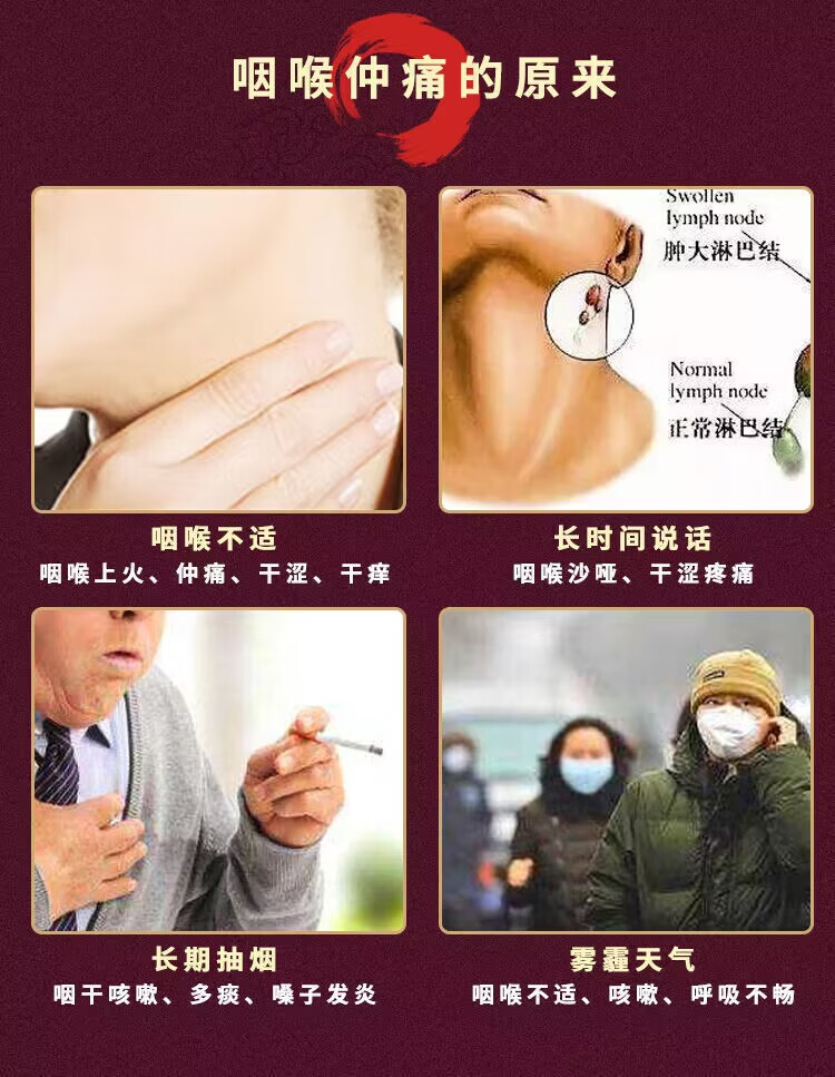 永森堂蜂胶咽喉炎喷剂慢性咽喉克异物感干呕喉咙肿痛干痒嘶哑止滤泡咳 买3+2【五盒巩固装】