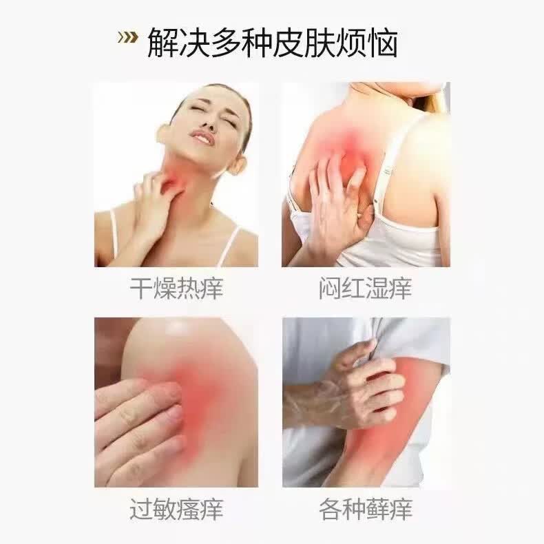 东方神郎刮码江西百年康御堂东方神郎双分子抑菌膏私处外用皮肤真菌止痒膏 25克