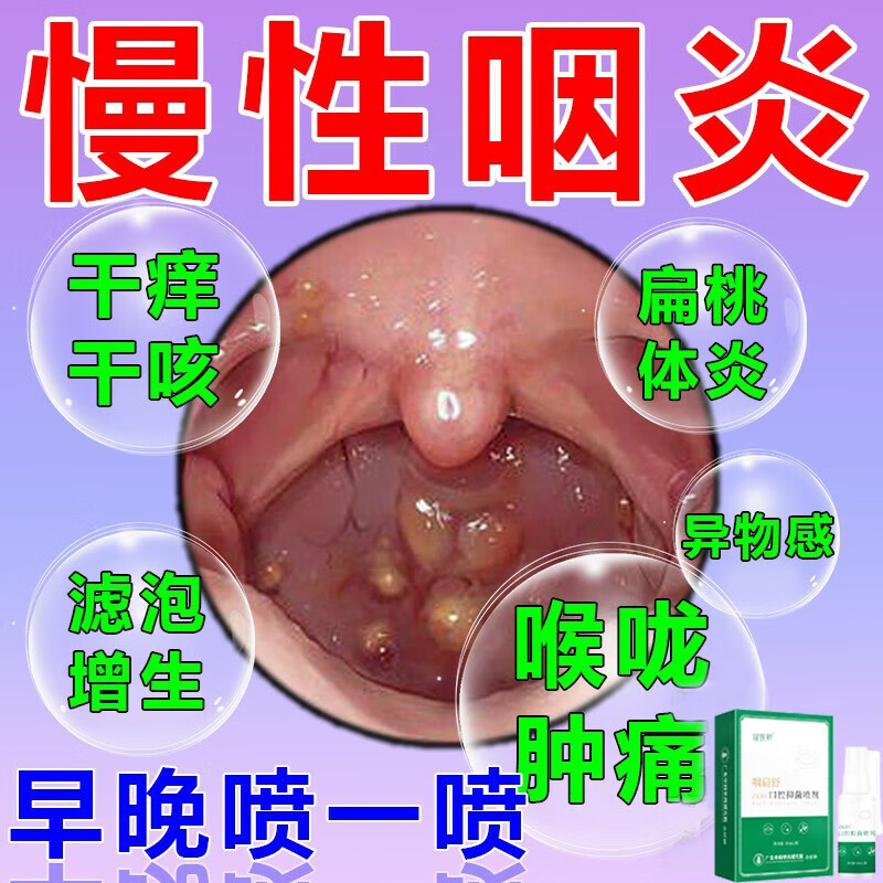 咽炎慢性咽炎除i根喷雾剂喉咙有异物桃体发炎肿痛痒肥大去除滤泡 一