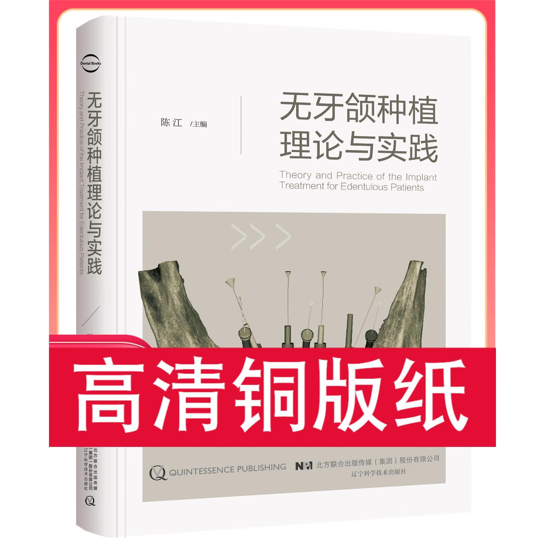 无牙颌种植理论与实践 铜版纸