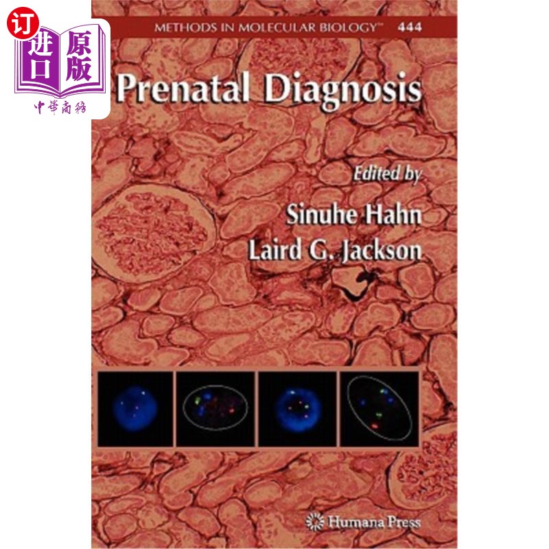 海外直订医药图书prenatal diagnosis 产前诊断