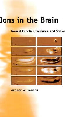 预订 ions in the brain