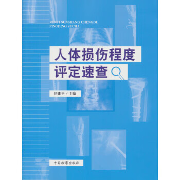 人体损伤程度评定速查 谷建平 中国检察出版社 9787510213335