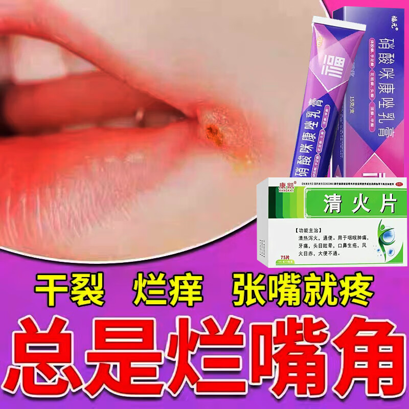 福元 硝酸咪康唑乳膏 20g/盒 嘴角溃烂软膏口角炎烂嘴角药膏 嘴角开裂