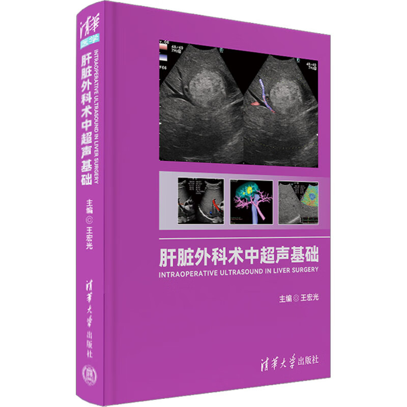 肝脏外科术中超声基础 图书