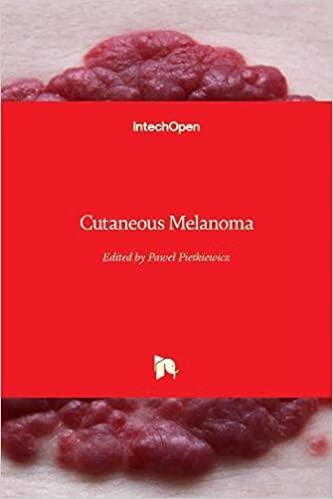 预订cutaneous melanoma