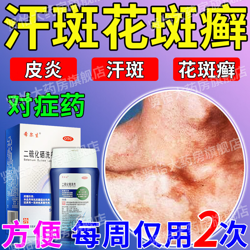 汗斑专用药 治疗汗斑花斑癣除斑根成人儿童体癣后背脖子白斑皮肤瘙痒
