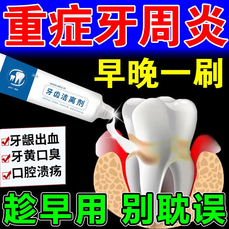 牙周炎专用牙膏牙龈萎缩修复牙齿松动固齿牙龈炎药牙膏 3盒【疗程装】牙周炎专用