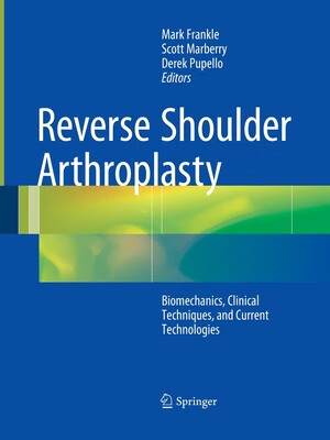 预订 reverse shoulder arthroplasty