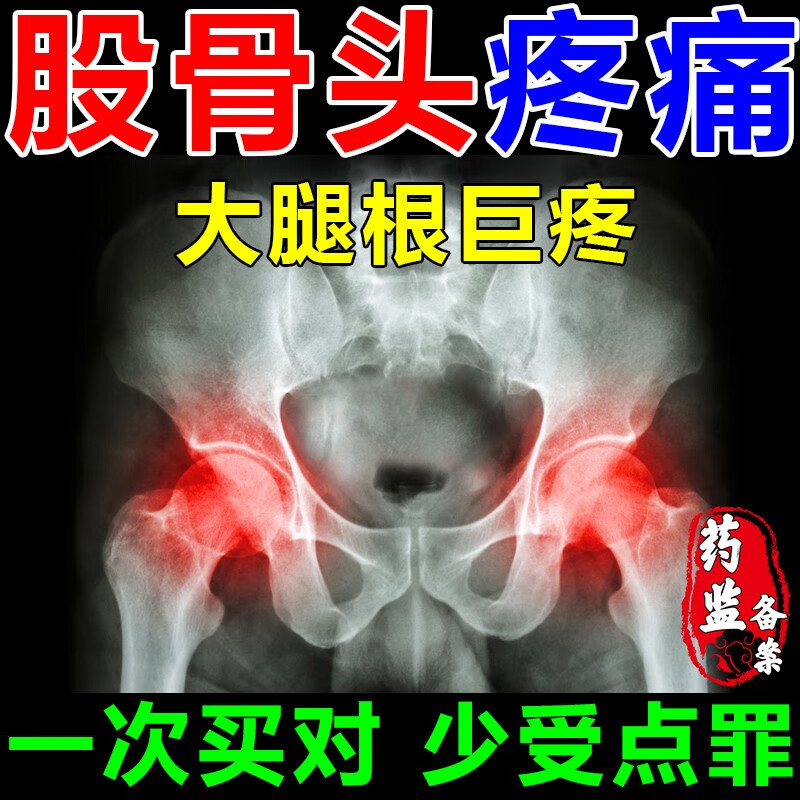 股骨头疼痛吃什么药】股骨头坏死疼痛专用口服药正髋