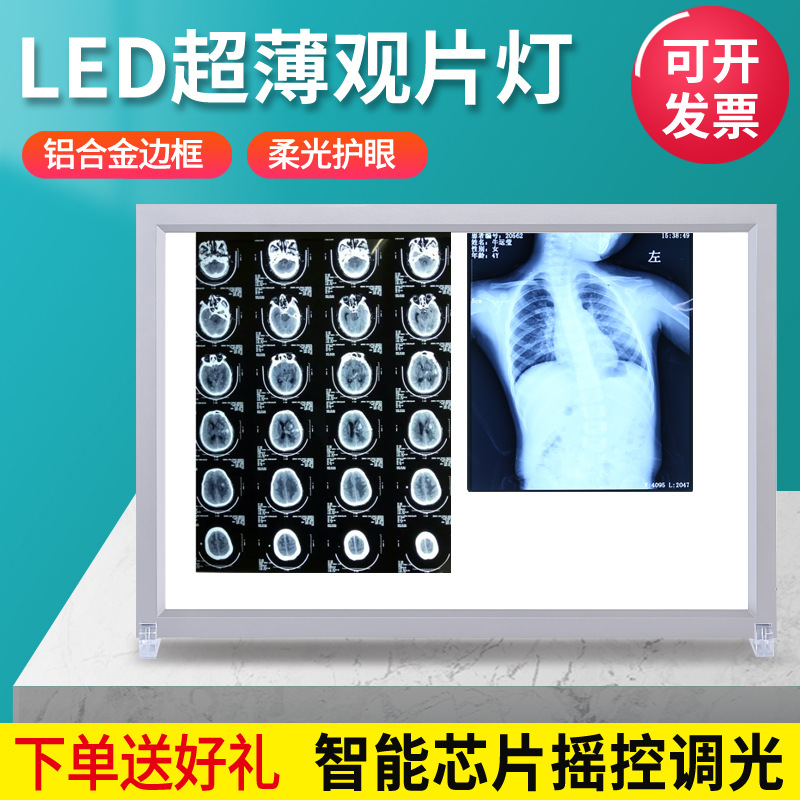 LED医用X光观片灯箱医院骨科口腔科单双三联胶片看片灯阅片灯 三联（手动开关）