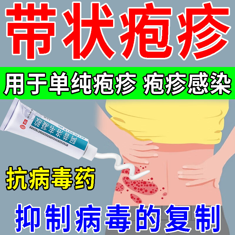 治带状疱疹外药 治疗蛇盘疮蛇缠腰带状疱疹后遗症神经痛抗病毒药