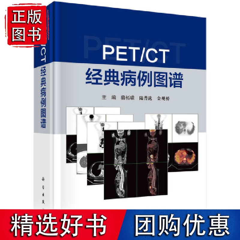 PET/CT 经典病例图谱