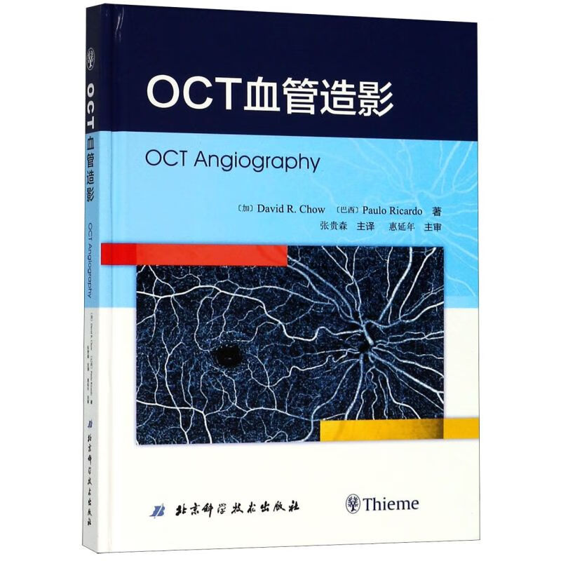 OCT血管造影(精)怎么样,好用不?